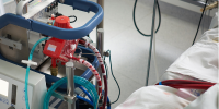 Extracorporeal Blood Transfusion Article Thumbnail